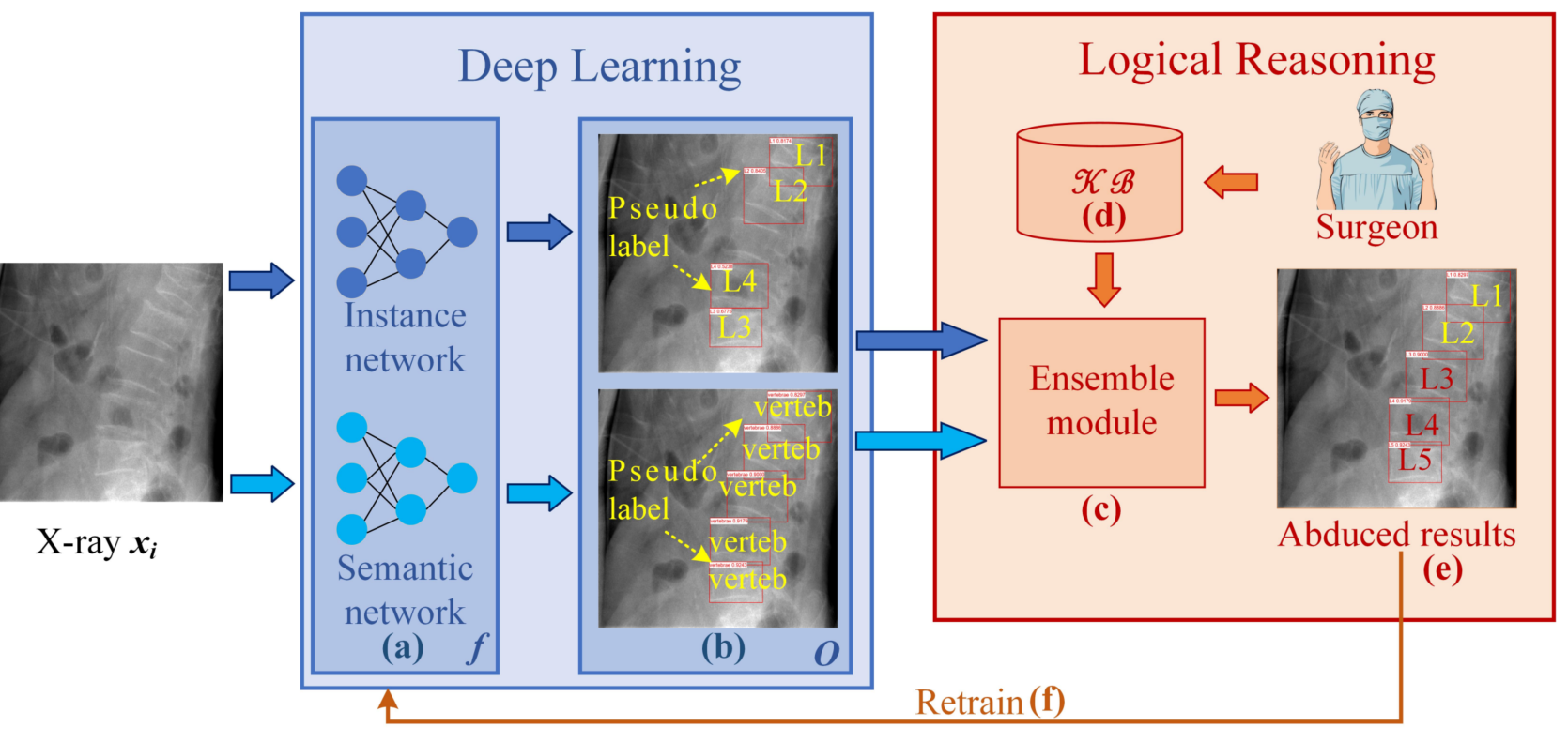 ABLSpineLevelCheck teaser image