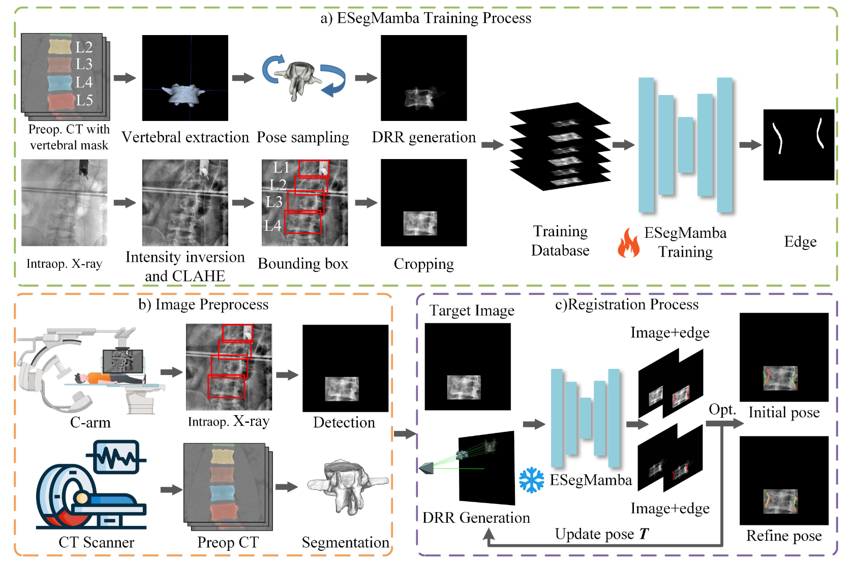 Semantic Edge-Guided registration image