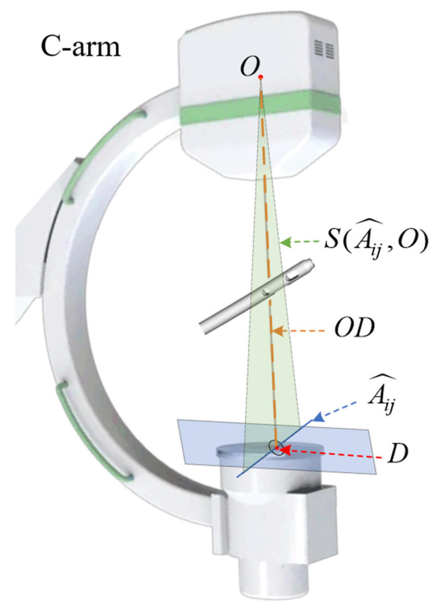 Intramedullary nail hole localization image