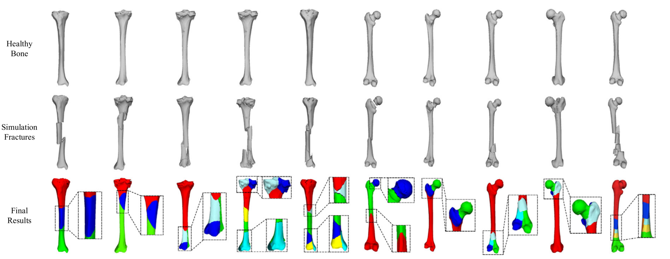 Synergistically segmentation image